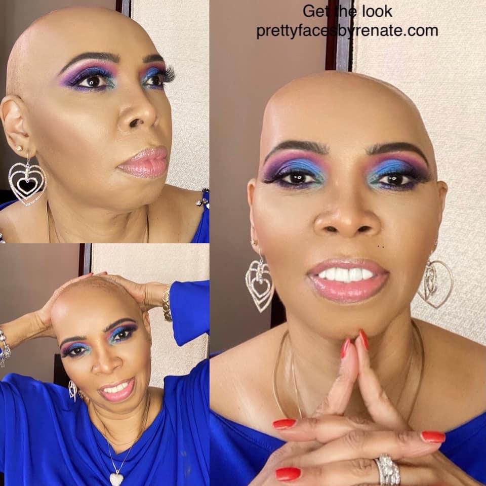 Redefining Beauty: Overcoming Alopecia with Sheena Wallace - I Have Alopecia, But Alopecia Does Not Have Me.